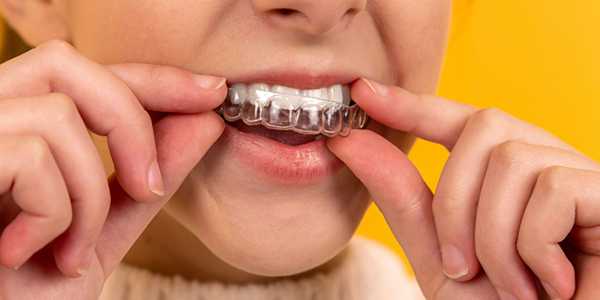 Orthodontic Coverage Secrets: How to Get Braces Paid For
